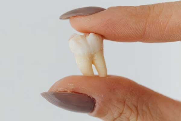 Dental Plaque